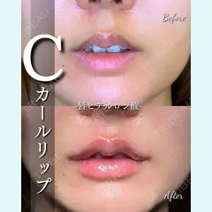症例