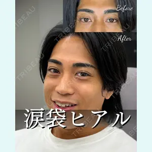 症例