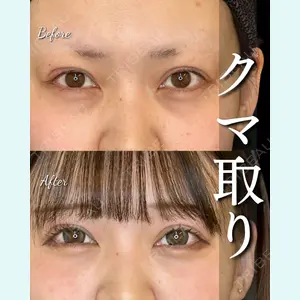 症例