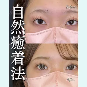 症例