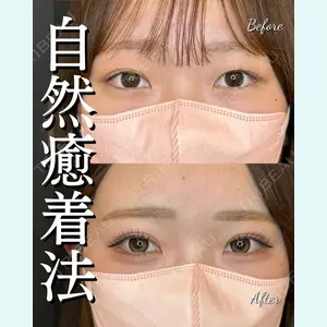 症例