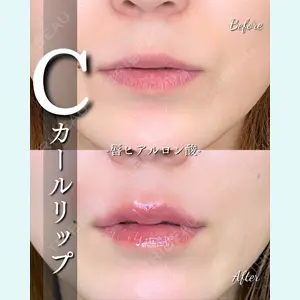 症例