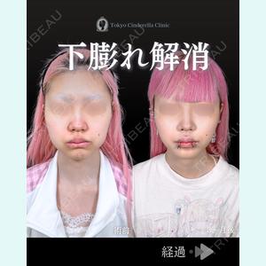 症例