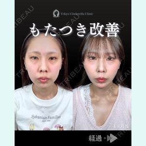 症例
