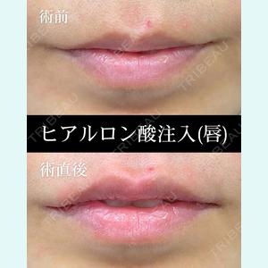 症例