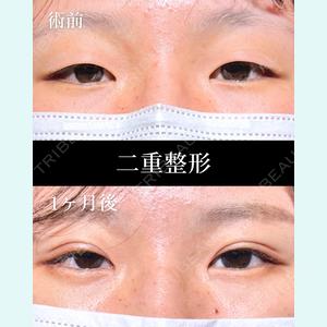 症例