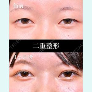 症例