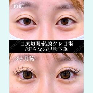 症例