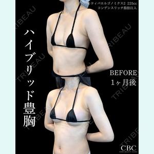 症例