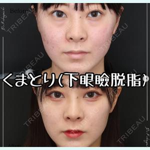症例