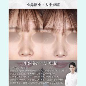 症例