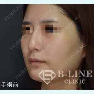 B-LINE CLINIC 池袋院 小池 康弘医師の症例