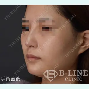 B-LINE CLINIC 池袋院 小池 康弘医師の症例