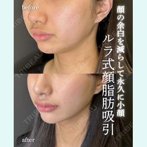 症例