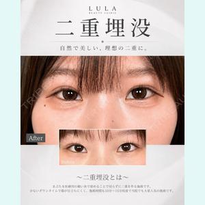 症例