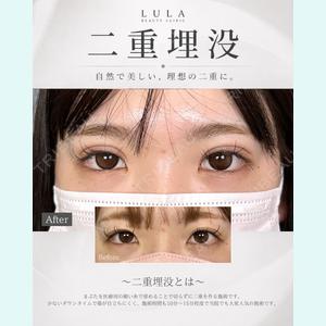 症例