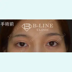 B-LINE CLINIC 池袋院 小池 康弘医師の症例