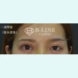 B-LINE CLINIC 池袋院 小池 康弘医師の症例