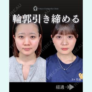 症例