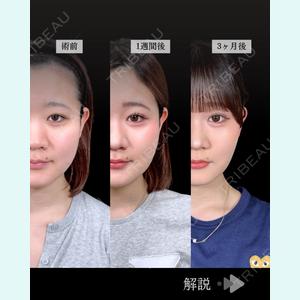 症例