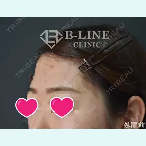 B-LINE CLINIC 池袋院 小池 康弘医師の症例