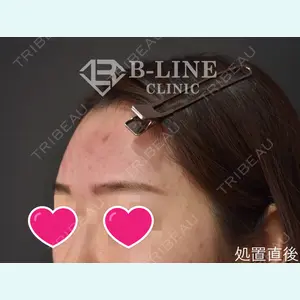 B-LINE CLINIC 池袋院 小池 康弘医師の症例