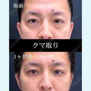 症例