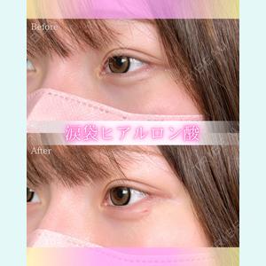 症例