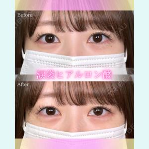 症例