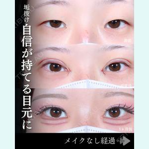 症例