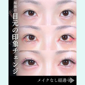 症例