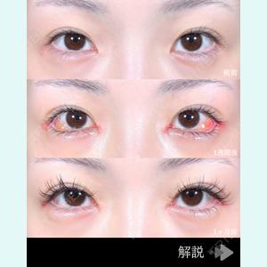 症例
