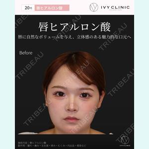 症例