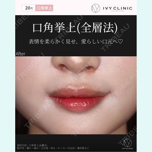 症例