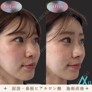 症例