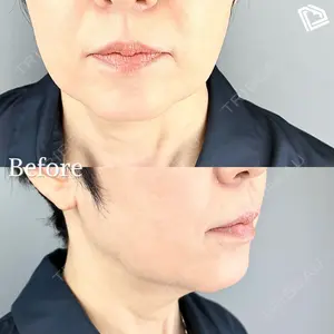 AB美容クリニック 新宿院 福田 美智子医師の症例