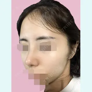 加美（GAMI）整形外科 パク・ゴヌク医師の症例