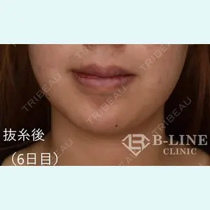 B-LINE CLINIC 池袋院 小池 康弘医師の症例