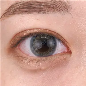 湘南美容クリニック 池袋東口院 赤尾 健医師の症例