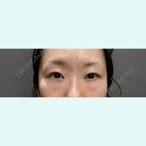 東京美容医療クリニック 池袋院 高 尚威医師の症例