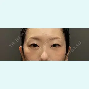 東京美容医療クリニック 池袋院 高 尚威医師の症例
