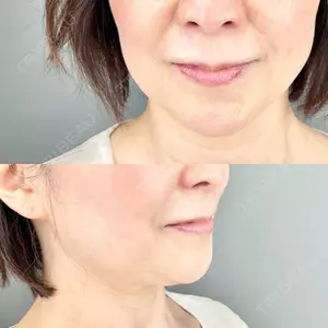 AB美容クリニック 新宿院 福田 美智子医師の症例