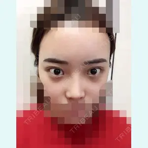 加美（GAMI）整形外科 パク・ゴヌク医師の症例
