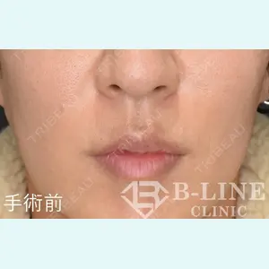 B-LINE CLINIC 池袋院 小池 康弘医師の症例