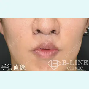 B-LINE CLINIC 池袋院 小池 康弘医師の症例