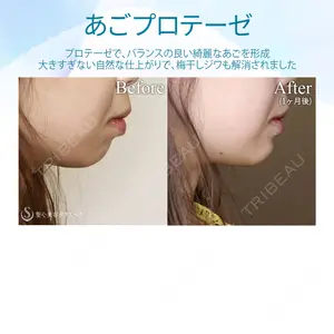 聖心美容クリニック 広島院の症例