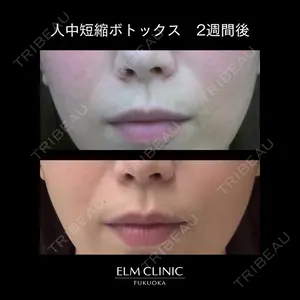 美容皮膚科エルムクリニック 福岡院 菊池 寛医師の症例