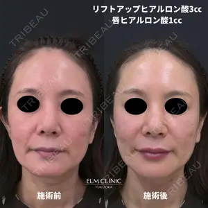 美容皮膚科エルムクリニック 福岡院 早川 祐輔医師の症例