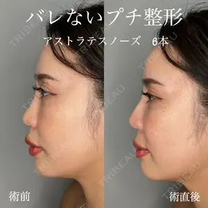 ASTRA BEAUTY CLINIC 塩満 惠子医師の症例