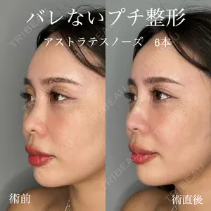 ASTRA BEAUTY CLINIC 塩満 惠子医師の症例